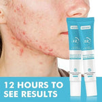 Charger l'image dans la galerie, MOOYAM Salicylic Acid Acne Gel
