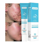 Charger l'image dans la galerie, MOOYAM Salicylic Acid Acne Gel
